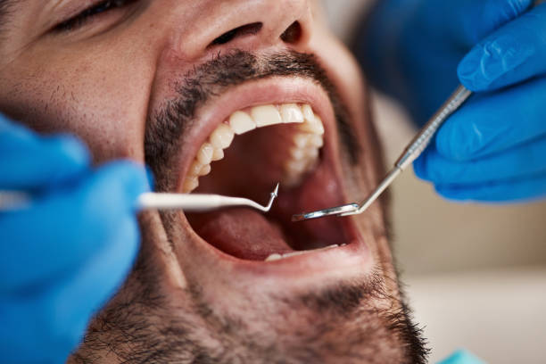 Best Emergency Cosmetic Dentistry in Millbrae, CA